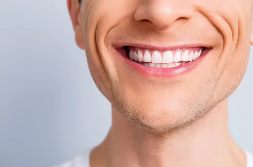 Can Protruding Front Teeth be Fixed with Veneers? 1 veneers singapore title